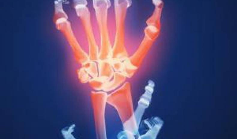 Osteoarthritis – What are the risk factors? To move or to save the joints?