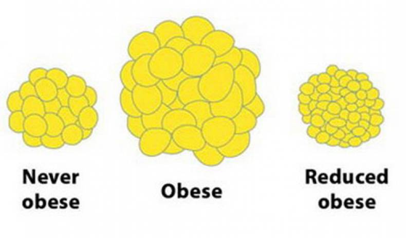 DO THE FAT CELLS DISAPPEAR WHEN WE LOSE WEIGHT?