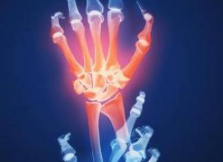 Arthrose – Sich bewegen oder Gelenke schonen? Sind Sie in Gefahr?
