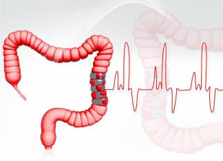 COLON HYDROTHERAPY - EFFECTIVE NATURAL TREATMENT