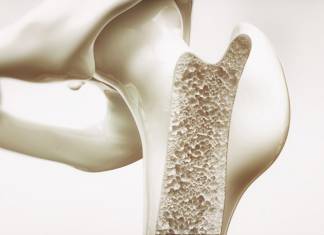 HOW TO PROTECT BONES FROM OSTEOPOROSIS: TIPS FROM HEALTH SPA EXPERT